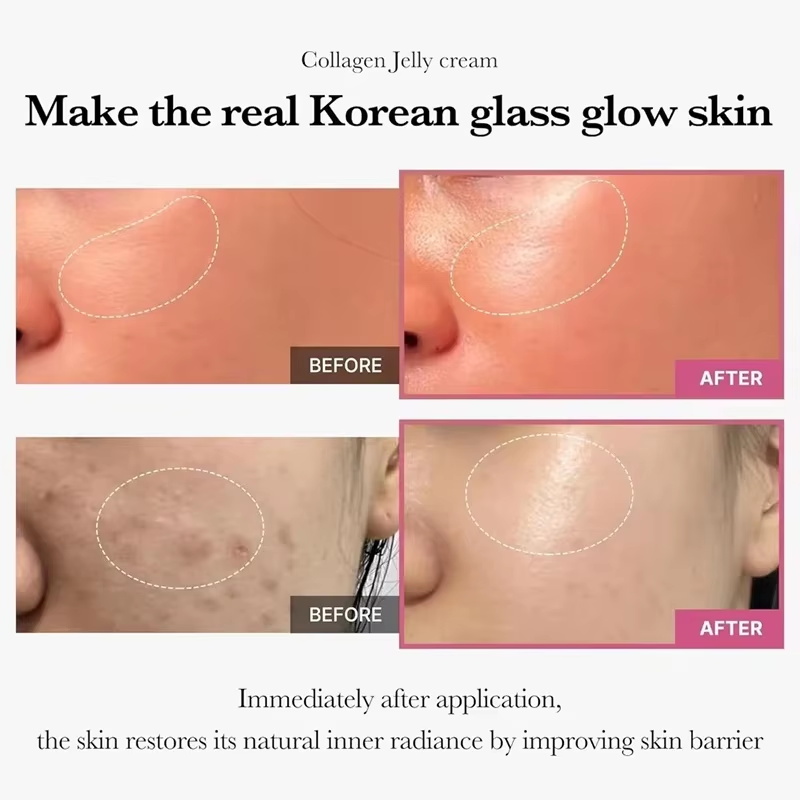 100g Jöle Yüz Kremi Kollajen Y - Niacinamide Pore Shrinking Essence incelemesi ve fiyatı