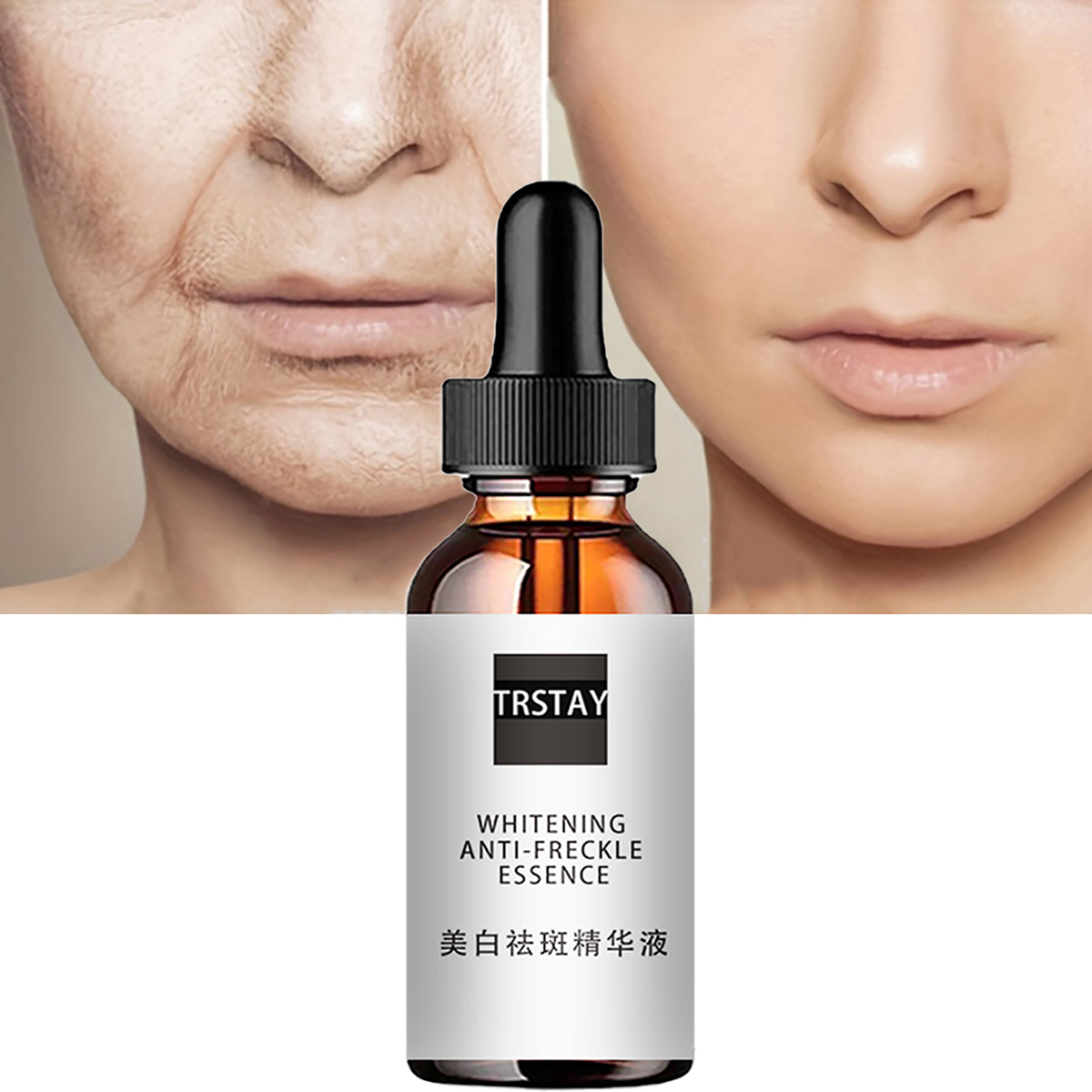 Niacinamide asit yüz özleri de - Niacinamide Pore Shrinking Essence incelemesi ve fiyatı