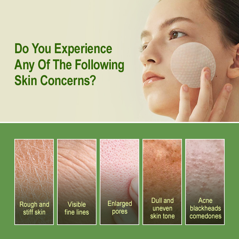 Salisilik Asit Peeling Pedleri - Salicylic Acid Blackhead Remover incelemesi ve fiyatı