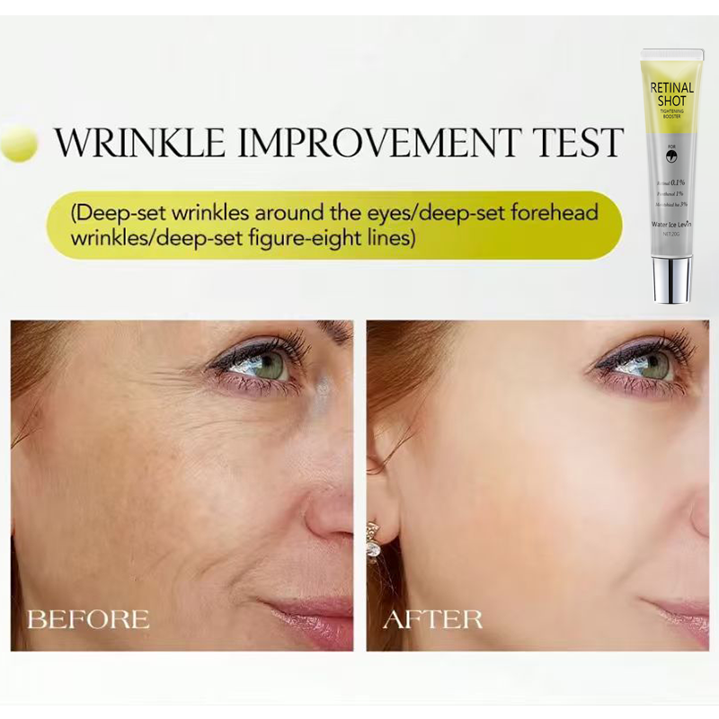 Retinal 0,1% Yoğun Bakım Panth - Retinol Anti Wrinkle Cream incelemesi ve fiyatı