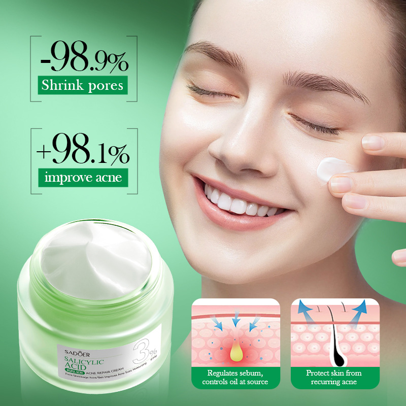 Salisilik Asit Akne Tedavi Kre - Salicylic Acid Blackhead Remover incelemesi ve fiyatı