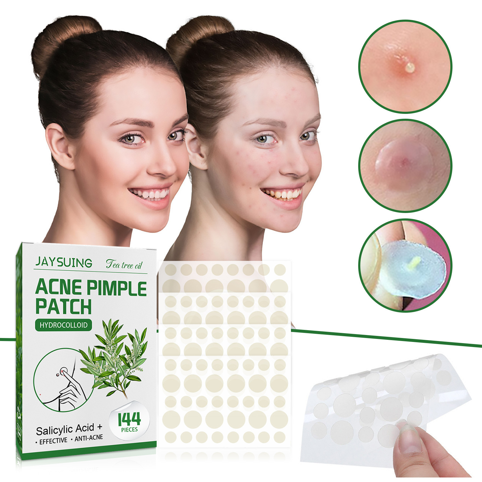 Hidrokolloid Akne Bantları - D - Hydrocolloid Pimple Patch incelemesi ve fiyatı
