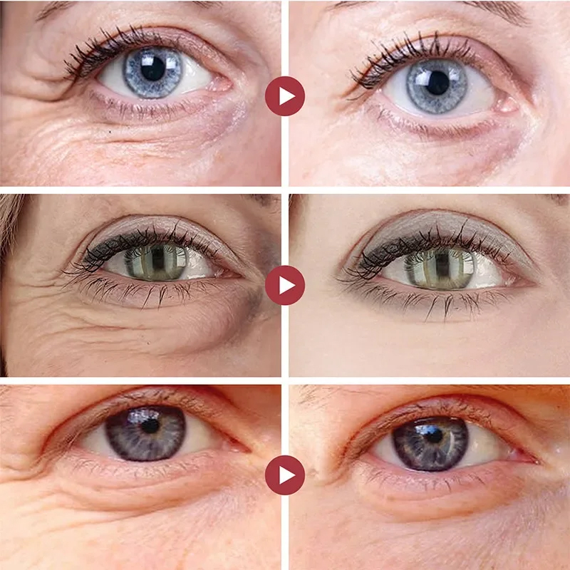 Kırışıklık Giderici Göz Bantla - Collagen Under Eye Patches incelemesi ve fiyatı