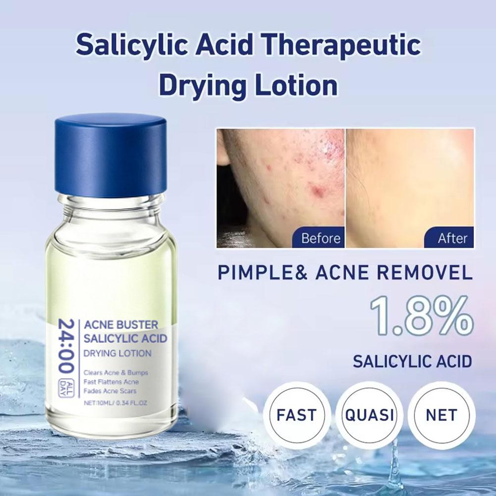 Salisilik Asit Sivilce Gideric - Salicylic Acid Blackhead Remover incelemesi ve fiyatı
